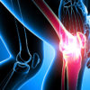 Knee Rehabilitation