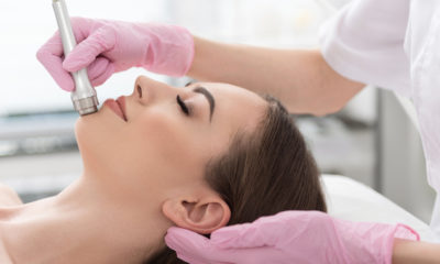 Microdermabrasion